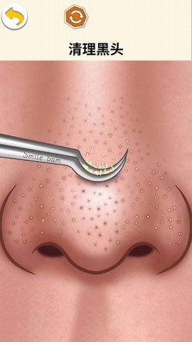 挤痘的乐趣 挤痘的乐趣